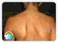 Лерочке нужна операция на позвоночнике!